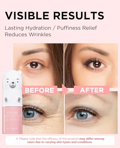 The SAEM Iceland Hydrating Collagen Eye Stick 0.24oz - Anti-wrinkle Moisturizing Eye Balm for Saggy Skin – Under Eye Treatment - Balm to Smooth Skin Texture - Rose Scent - Thumbnail 4