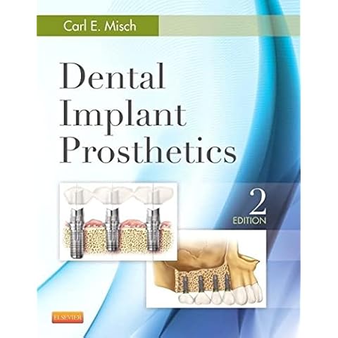 Dental Implant Prosthetics Cover