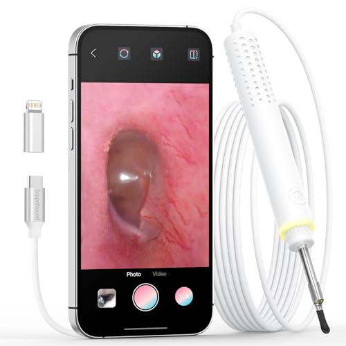 ScopeAround Otoscope for iPhone, 3.9mm Ultra-Thin Ear Camera with 6 LED Lights, Digital Otoscope with Ear Wax Removal Tool, USB Ear Cleaning Camera Compatible with iPhone/Android (No WiFi Needed)