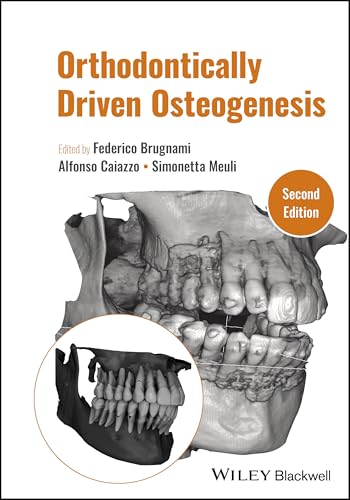 Orthodontically Driven Osteogenesis view 2