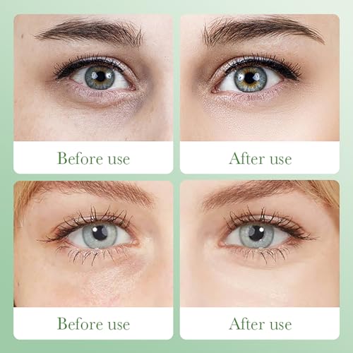 60 almohadillas para los ojos, almohadillas de colágeno, antiojeras, antiojeras, ácido hialurónico con aloe vera, parches antienvejecimiento, eliminan arrugas, bolsas de ojos, hinchazón, hidratantes - imagen 9