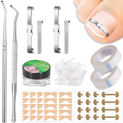 Joycabin Eingewachsene Zehennägel Set, Fußnagel Eingewachsen Spange Nagelspangen Zehennagel Korrektur Patch für Nagelpilz Fusspflege Nagelzange Set für Eingewachsene Fußnägel