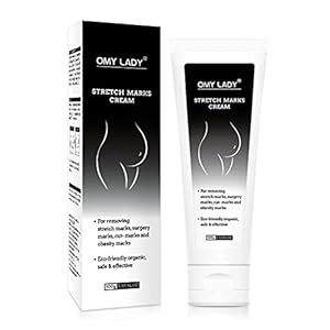 Tumnea Crème striae verwijderen crème voor het verwijderen van striae lichaam billen borstvlekkencrème huidverzorging…