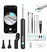 Amazon.co.jp: BEBIRDPRO 耳かき カメラ イヤースコープ 1080P HD画質