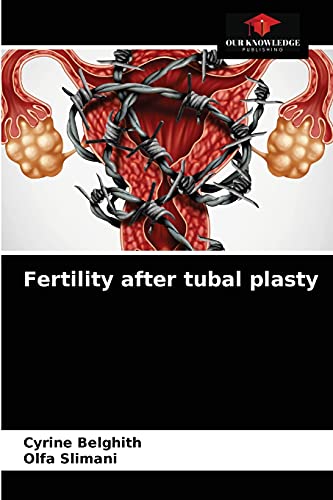  Fertility after tubal plasty