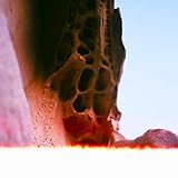 oligophrenie wiki  Oligo