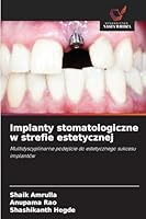 Implanty stomatologiczne w strefie estetycznej 6209107559 Book Cover