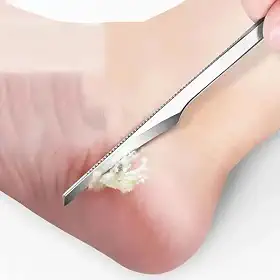 Kit profissional de pedicure – Pacote com 3 lixas para pés e removedores de calos de aço inoxidável – Raspador de pele morta para homens e mulheres – Ferramentas duráveis de cuidados com os pés para