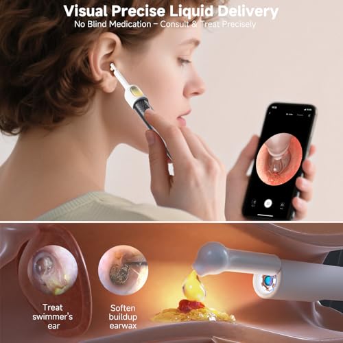 bebird r1 ultra ear wax removal ear cleaner with camera ear scope wax remove ear pick with ear otoscope tweezers visual dropper cleaning kit earnosethroat examination tool for family