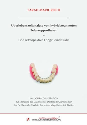 Überlebenszeitanalyse von hybridverankerten Teleskopprothesen - Eine retrospektive Longitudinalstudie (Edition Scientifique)