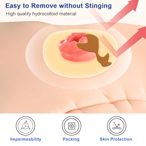 6 Stück Stoma Barriereringe 2mm Stomabeutel Stoma Barrier Tapes Absperrstreifen Selbstklebende Stomaversorgung für Kolostomiebeutel