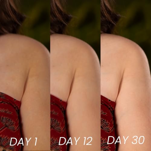 Image of Kojic Acid & Saffron Detan Scrub Soap With Turmeric & Niacinamide | Skin Brightening Soap | Dark Spots, Pigmentation & Tan Removal Bathing Soap For Men & Women (Pack of 3)