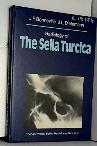 Radiology of the Sella Turcica