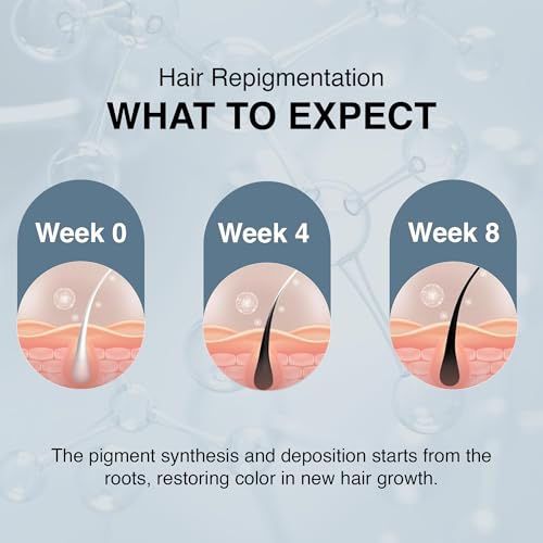 Image of ThriveCo Anti Grey Hair Prime Serum | Naturally Reverse Greying Hair & Beard | Advanced Clinically Proven Treatment | With Arcedin + Arcolys + Biotin | Light Weight, Non-Sticky | Men & Women |30 ml