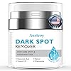 Dark Spot Remover for Face and Body – Brown Spots Corrector for Sun Spots, Age Spots, Freckles, Melasma–Moisturizes Face Cream K88