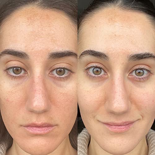 True Botanicals - Organic Vitamin C Booster Powder | Clean, Non-Toxic, Natural Skincare (.49 Oz | 14 G) #TOP6