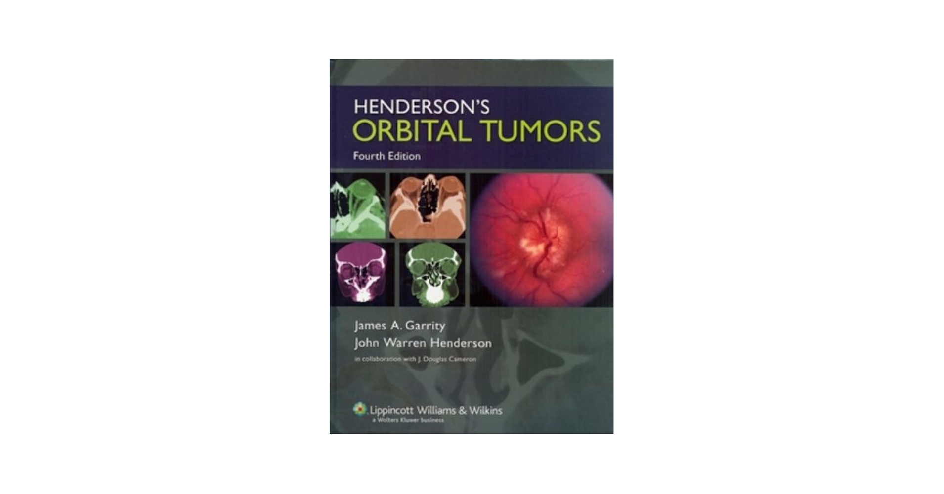 Henderson's Orbital Tumors: 9780781738699: Medicine & Health