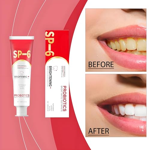 Sp-6 Toothpaste, 2pc Sp-6 Probiotic Toothpaste, Intense Whitening Toothpastes, Probiotische Zahnpasta, Deep Cleaning Care Toothpastes – Bild 7