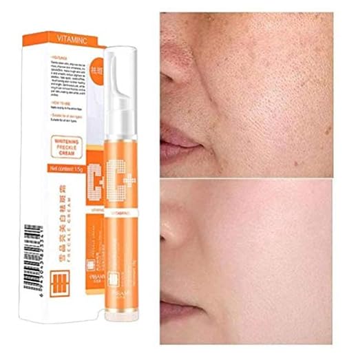 LifeBest 15g Crema blanqueadora Antimanchas VC Eliminación de Manchas de pecas Crema blanqueadora Tratamiento Facial antienvejecimiento para hiperpigmentación