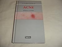 A Pocket Guide to Acne 1870026500 Book Cover