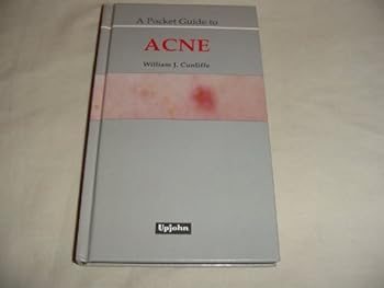 Hardcover A Pocket Guide to Acne Book