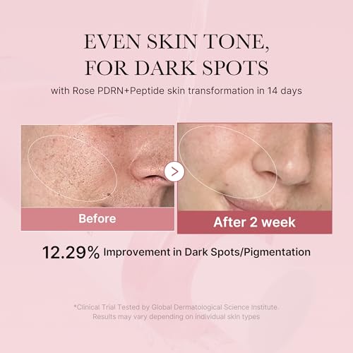 medicube PDRN Toner Rose PDRN Peptide Toner | Lightweight & Watery Type for Skin Boosting, Soothing and Calming, Uneven Skin Tone | with Rose, Peptide, Niacinamide | Korean Skincare, 8.45 fl.oz - Image 3