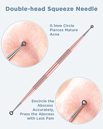 image for TAYTHI Blackhead Remover Tool, Pimple Popper Tool Kit, Blackhead Extra