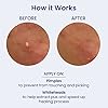 FaceTory-PM-Spot-Fighter-Blemish-Patches-OvernightNighttime-156-Hydrocolloid-Patches-12mm-and-14mm-2-Packs-of-78-Patches FACETORY PM Spot Fighter Blemish Patches - Overnight/Nighttime Pimple Patch, For Acne-Prone Skin - 156 Hydrocolloid Patches, 12mm and 14mm (2 Packs of 78 Patches)