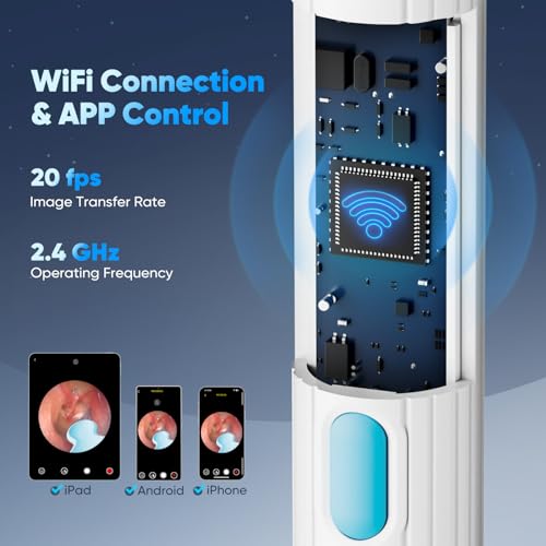 MOOPHY イヤーワックス除去ツール キット8個&イヤースプーン5個付き の商品画像 4