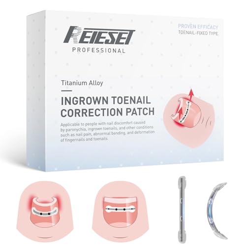 Titanium Alloy Ingrown Toenail Treatment, NailTools, and Ingrown Toenail Removal Kit SpeciallyDesigned for Curved Nail Repair and Ingrown ToenailCorrector (0.67/0.79in)