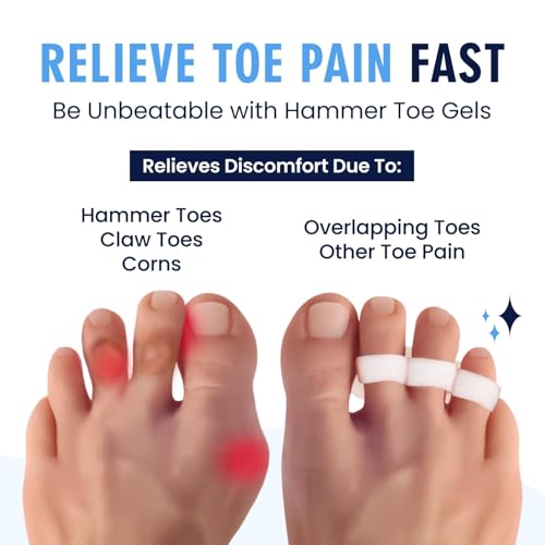 Image of Bunion Corrector Silicone Toe Separators For Fast Pain Relief - Orthopedic Bunion Spacers Spreader Free Size (3 Loop)