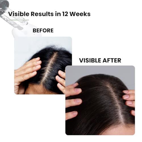 KAYROQ Advanced Hair Growth Serum 30 ml - Image 5