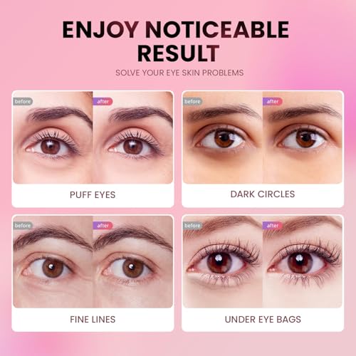 AILEORY Under Eye Patches (24 Pairs) - Tri-color Glitter Eye Gel Pads for Dark Circles, Puffy Eyes, Under eye Bags, Wrinkles | Natural Collagen Under Eye Mask Patches, for Mom