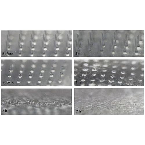 Patchs hydrocolloïdes acné Frilliance | Lot de 4 patchs microdart boutons visage - 4