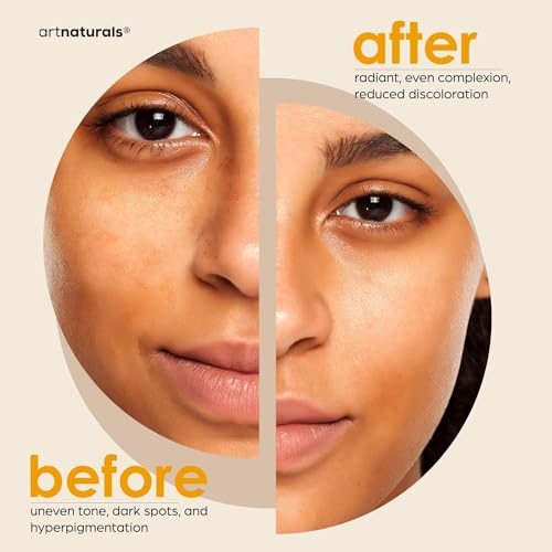 Artnaturals Kojic Acid Soap + African Net Sponge (2 pack X 142g Turmeric bars) Dark spot remover & Scars - Original Japanese Complex Vitamin C, Hyaluronic Acid, retinol, shea butter (Citrus) - Thumbnail 4