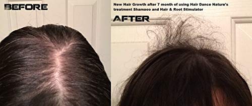 Hair Growth Stimulator for Thicker, Faster Hair Growth, & Healthy Scalp | Plant Based | Research-Based Caffeine, L-arginine Potent DHT Blocker | Herbal, Hair Loss Treatment 4 ounce by Hair Dance
