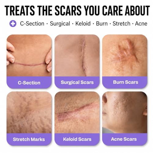 Silicone Scar Tape — Medical-Grade, 1.6
