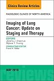 Lung Cancer, An Issue of Radiologic Clinics of North America (Volume 56-3) (The Clinics: Radiology, Volume 56-3)