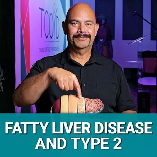 Fatty Liver Disease and Type 2 Diabetes