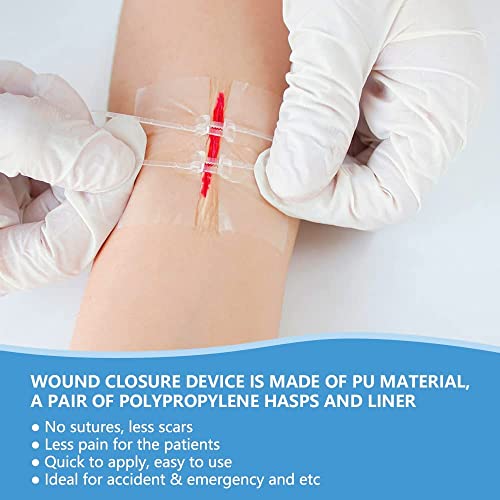 Smerphox  Wound Closure Strip, Sterile First Aid Band Kit, Zip Stitch Suture-Free, Adhesive Stitch Emergency Wound Close Device,Adhesive Bandages For Wound Care & First Aid Skin Injury (4Pcs) #TOP4