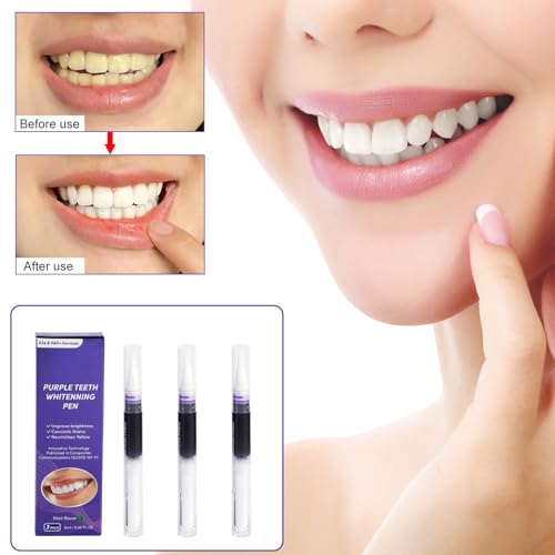 iwontalersy 3 Stück Zahnaufhellung Stift,Purple Teeth Bleaching Stift,Zähne Aufhellen Efficiently Schnelles Removes Tough Stains