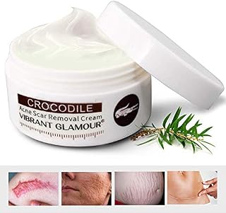 Scar Removal Cream For Old Scars -Stretch Mark Removal Cream for Men