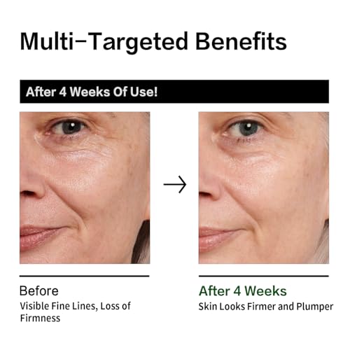 RAZUYEN Retinol Serum for Face, Anti Aging Serum with Peptide for Fine Lines and Wrinkles, Smoothing, Repairing and Hydrating Face, 30ml (1 Fl Oz) - Image 7