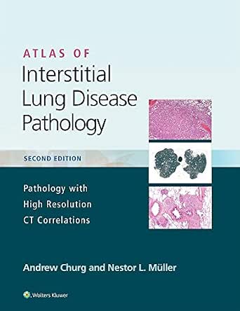 Amazon.com: Atlas of Interstitial Lung Disease Pathology eBook : Churg ...