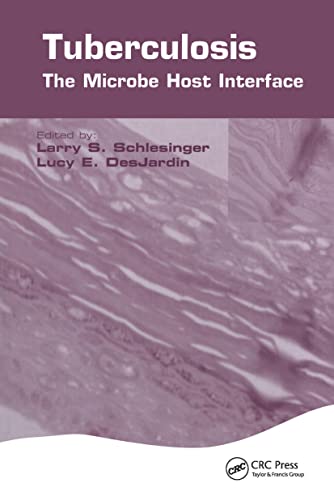 Tuberculosis: The Microbe Host Interface