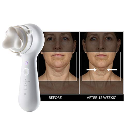 Clarisonic New Mia Smart Skincare Set, White #TOP3