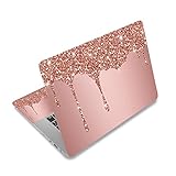 Onannos Laptop Skin Cover Sticker Decal, Personalized12 13 13.3 14 15 15.4 15.6 inch Laptop Decal, Reusable Universal Vinyl Skin Sticker Art Cover with Decorative Waterproof Design(A-Stylish)