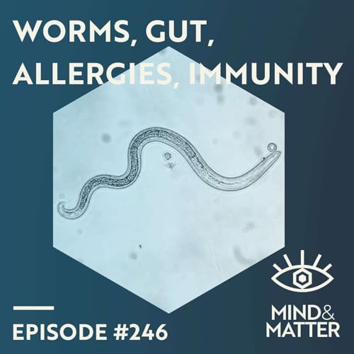 Page de couverture de Appendix, Gut Worms, Allergies & Autoimmunity | William Parker | 246