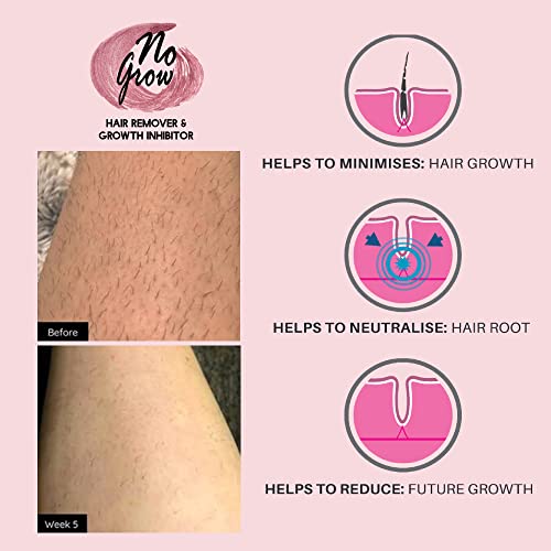 Nogrow - Permanent Hair Inhibitor & Removal For All Hair & Skin Colors (Female Facial) | Laser Hair Removal In A Tube | Get Rid Of Unwwanted Peach Fuzz, Mustache Hairs, And Beard Hairs #TOP4