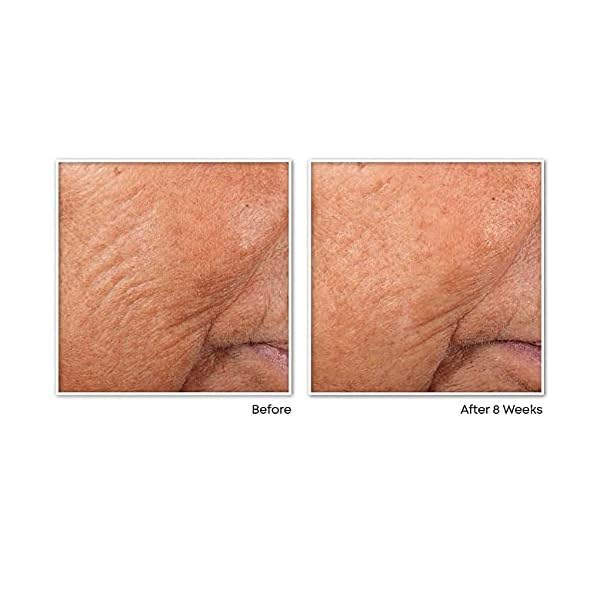 RoC-Retinol-Correxion-Line-Smoothing-Night-Serum-Capsules-10-Count RoC Retinol Correxion Line Smoothing Night Serum Capsules, Daily Anti-Aging Skin Care Treatment for Fine Lines, Dark Spots, Acne Scars, Stocking Stuffers for Men & Women, 10 Count